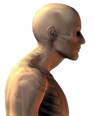 Forward-head-posture-condition